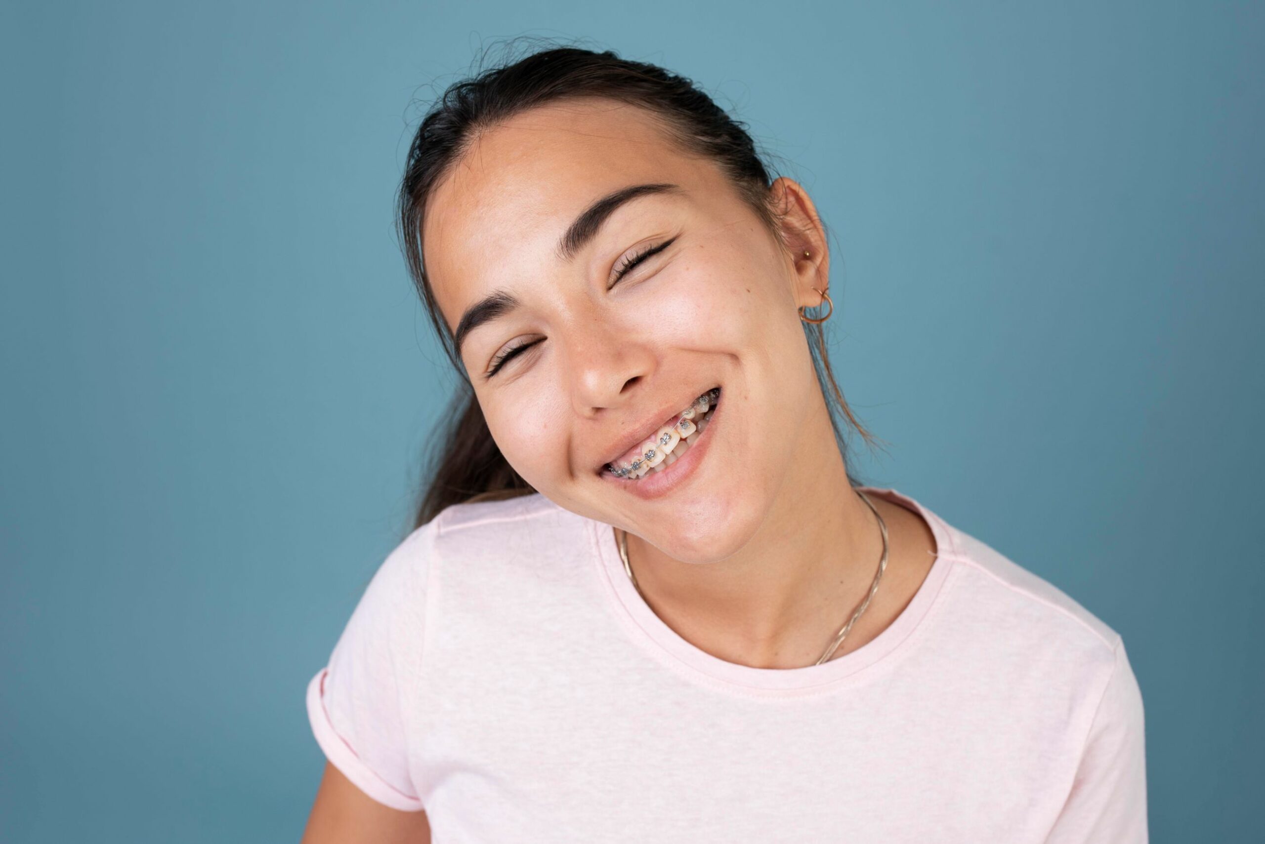 Ceramic Braces in Midland TX - Clear Bracket Braces